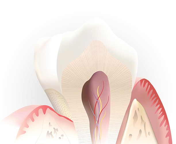 Animated inside of a tooth before root canal therapy