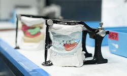 Dentures being crafted at dental lab