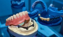 Nearly complete denture at dental lab