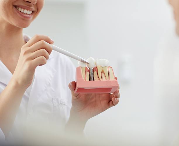 dentist showing a patient a model of a dental implant in the jaw 