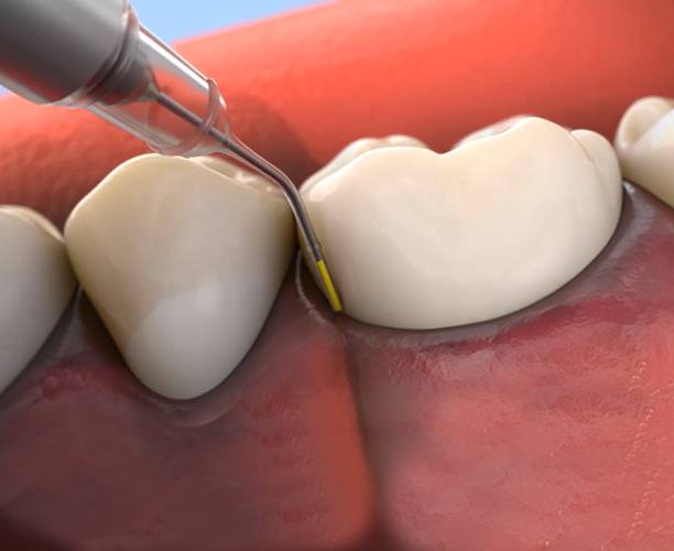 Animated smile during antibiotic therapy treatment