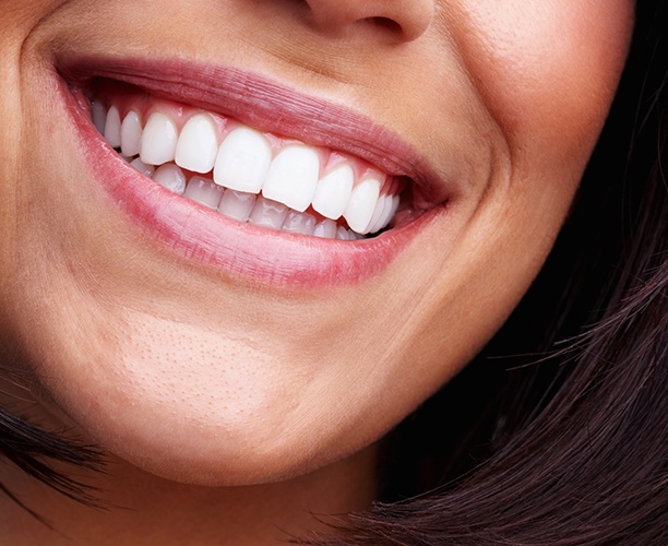 Woman with bright white smile after teeth whitening