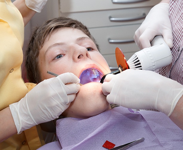 A boy getting dental sealants placed