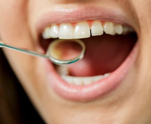 Closeup of smile during dental cleaning visit