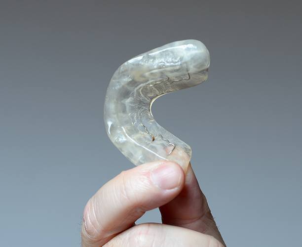 Hand holding an occlusal splint used for T M J therapy