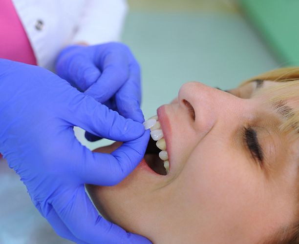 female patient gets veneers in Las Cruces