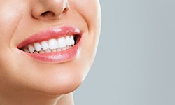 Nose-to-neck image of woman smiling with white teeth