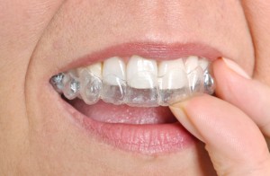 dentist in las cruces provides invisalign