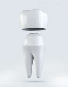 Your dentist in Las Cruces offers same-day dentistry with CEREC technology.