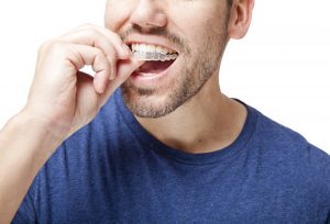 Get answers to your questions about Invisalign in Las Cruces. 