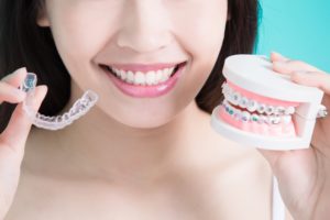 Dental models showing Invisalign VS. braces