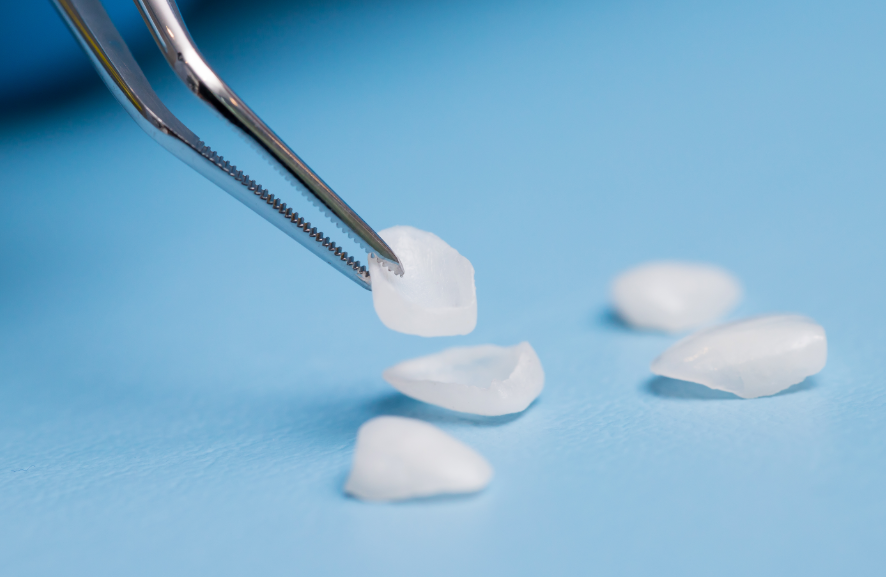 Close up of veneers